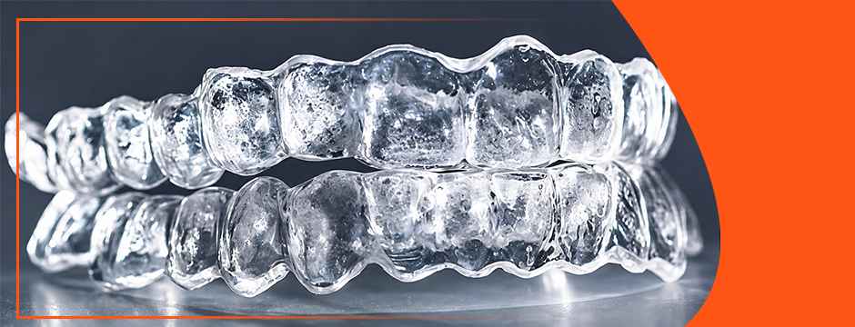 Aligners for Teeth: How Clear Aligners Boost Confidence and Oral Health featured image
