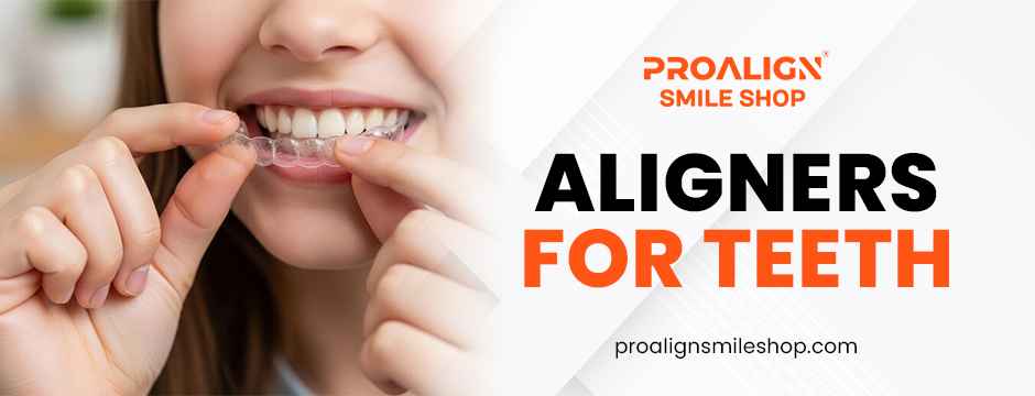 Aligners for Teeth: Step-by-Step Treatment Process Explained featured image