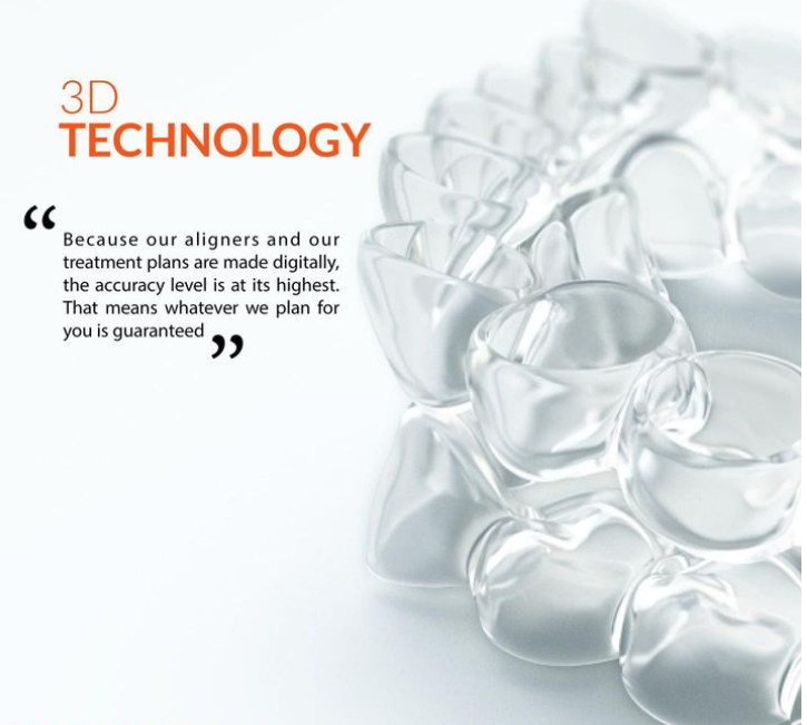 3D technology used for digitally planned clear-aligner treatment