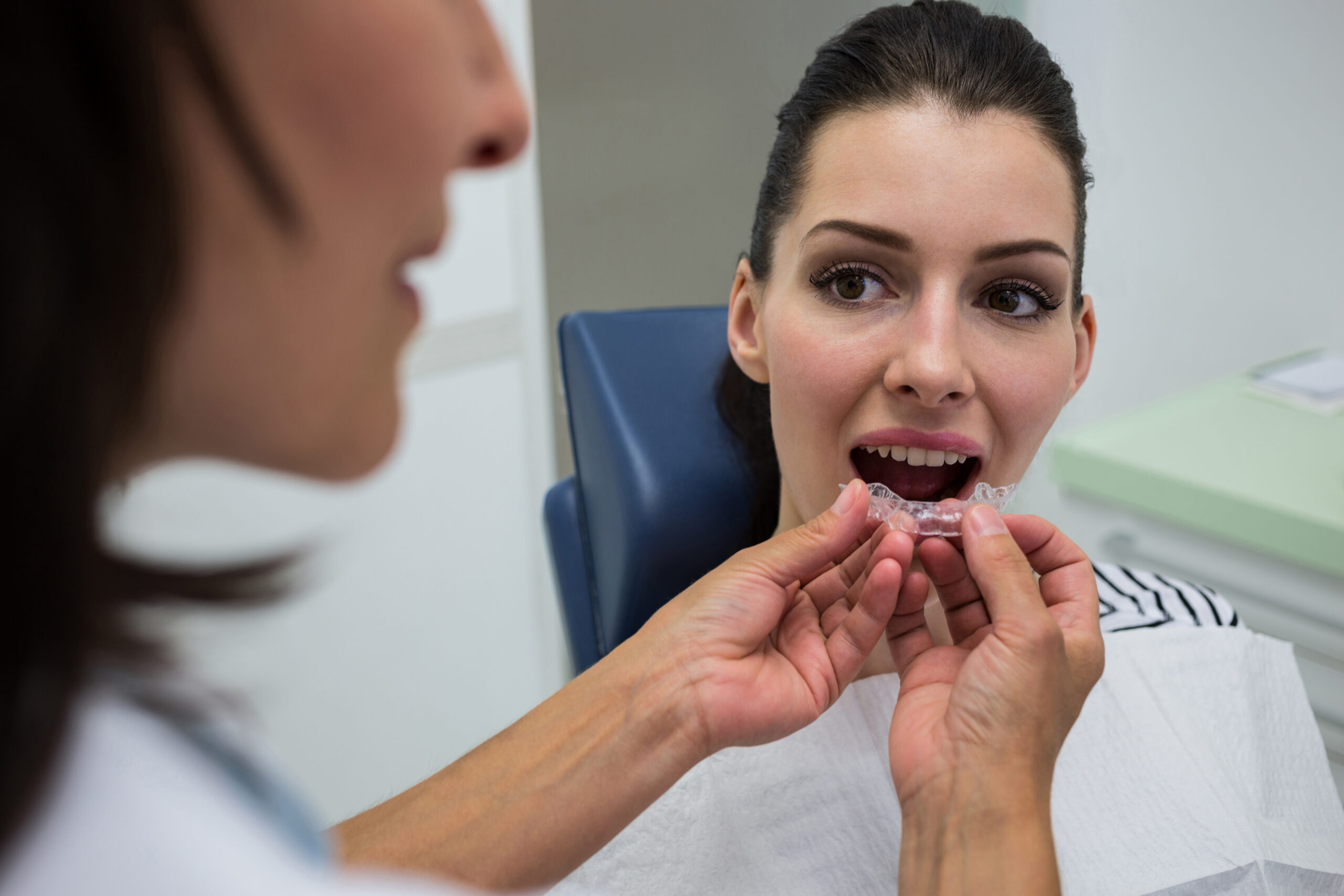 How Much Do Clear Aligners Cost in Dubai featured image