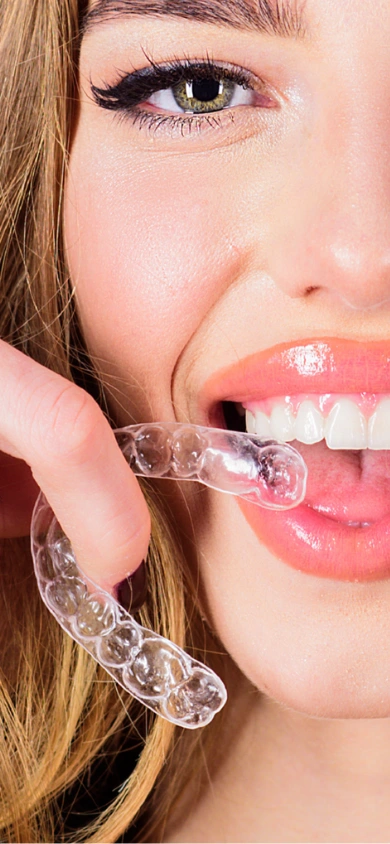 Clear aligner patient smiling