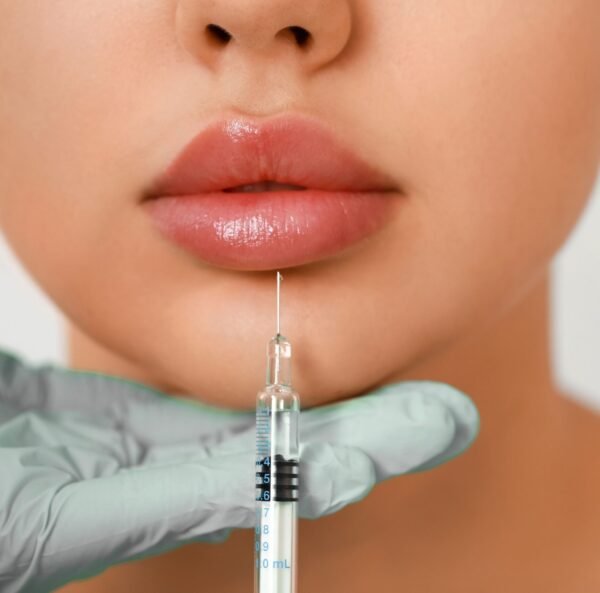 Proalign Clinic Face & Smile for Lip Fillers