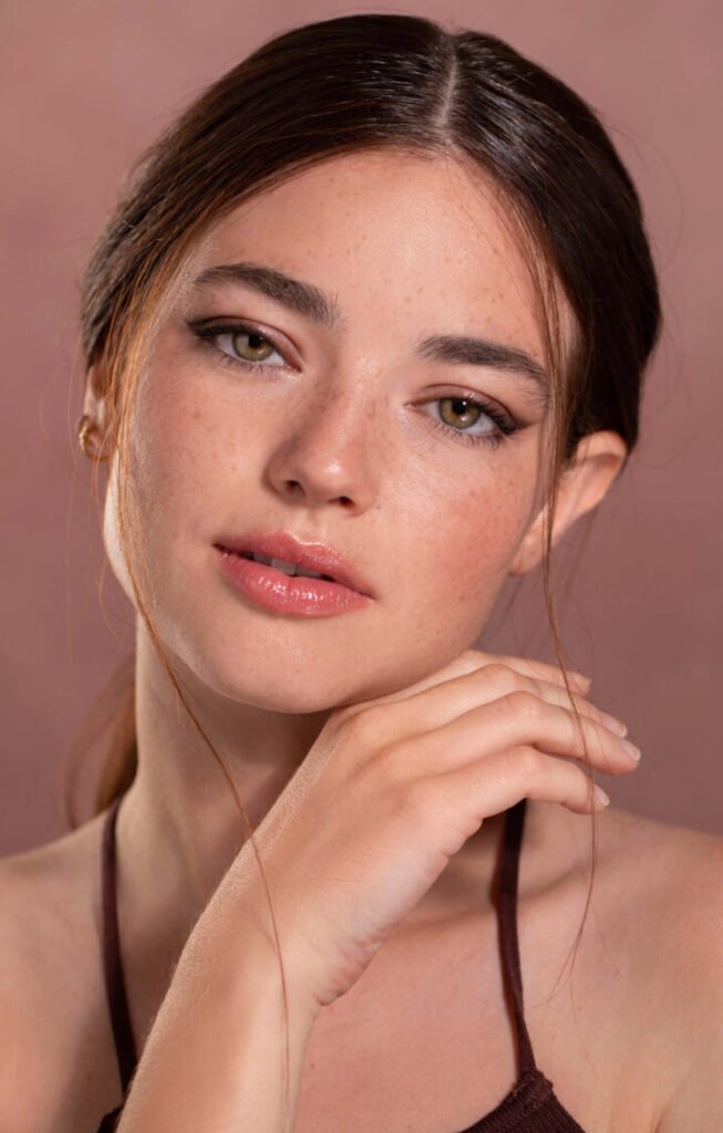 smile line filler in dubai business bay. proalign face & smile clinic.