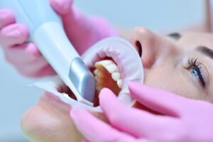 clear aligners free consultation in dubai