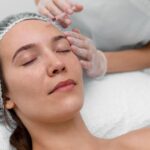 Why Microneedling Is Popular for Treating Acne Scars and Open Pores