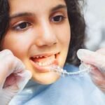 Fitting clear aligners on teeth for a child receiving invisalign treatment in dubai