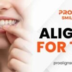 Person wearing clear aligners for teeth by Proalign Smile Shop