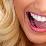 Aligner Teeth: Common Mistakes That Can Delay Your Progress Aligner Teeth: Common Mistakes That Can Delay Your Progress