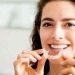 How Long Does a Clear Smile Aligner Take to Show Results